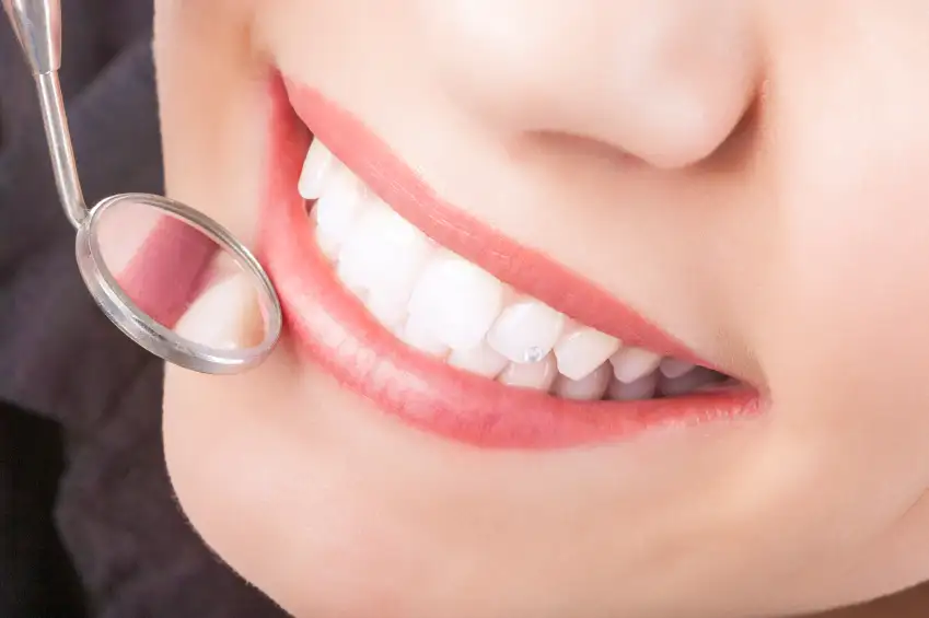A woman smiling with Crown Lengthening in Seattle, WA. A woman smiling with Crown Lengthening in Seattle, WA.