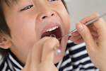 A kid receiving dental care in Spokane Valley Washington