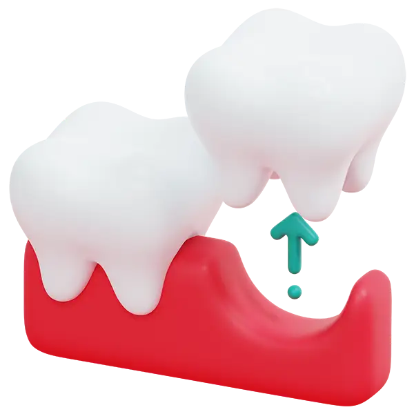 A tooth lifted upward out of the gums, demonstrating the basics of tooth extraction. A tooth lifted upward out of the gums, demonstrating the basics of tooth extraction.